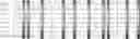 Fig. 75 - Method for HLA typing