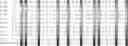 Fig. 77 - Method for HLA typing