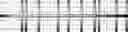 Fig. 85 - Method for HLA typing