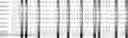Fig. 91 - Method for HLA typing