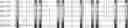 Fig. 98 - Method for HLA typing