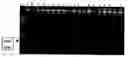 Fig. 01 - Probe and primer for tubercle bacillus detection, and method of detecting human tubercle bacillus therewith