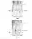Fig. 04 - Method of extracting chromatin fractions from intact cells