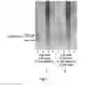 Fig. 08 - Method of extracting chromatin fractions from intact cells