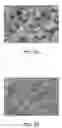 Fig. 03 - Method and apparatus for in vivo surveillance of circulating biological components
