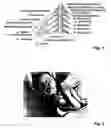 Fig. 02 - METHODS AND APPARATUS TO RECOGNIZE NERVE INJURIES