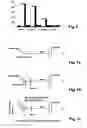 Fig. 05 - METHODS AND APPARATUS TO RECOGNIZE NERVE INJURIES