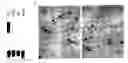 Fig. 01 - Methods of modulating cold sensory perception via a cold- and menthol-sensitive receptor (CMR1)