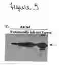 Fig. 07 - System for expression of genes in plants