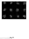 Fig. 11 - Multianalyte Molecular Analysis Using Application-Specific Random Particle Arrays