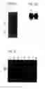 Fig. 20 - Fibroblast growth factor (FGF23) polypeptides