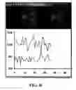 Fig. 09 - METHOD AND APPARATUS FOR MOVING STAGE DETECTION OF SINGLE MOLECULAR EVENTS