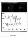 Fig. 10 - METHOD AND APPARATUS FOR MOVING STAGE DETECTION OF SINGLE MOLECULAR EVENTS