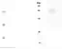 Fig. 01 - Macrolide compounds containing biotin and photo-affinity group for macrolide target identification