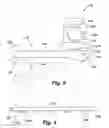 Fig. 06 - Method and system for washing intestines