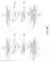 Fig. 11 - Game program, game apparatus, and game control method