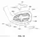 Fig. 13 - Golf club head