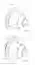 Fig. 02 - LOCKABLE DIFFERENTIALS