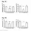 Fig. 04 - System for seizure suppression