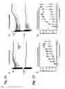Fig. 10 - System for seizure suppression
