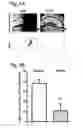 Fig. 12 - System for seizure suppression