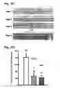 Fig. 13 - System for seizure suppression