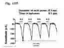 Fig. 18 - System for seizure suppression