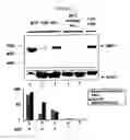 Fig. 04 - Use of IMP3 as a Prognostic Marker for Cancer