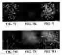 Fig. 10 - Water-soluble fluorescent particle comprising entangled fluorescent polymer and amphiphilic molecule