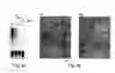 Fig. 07 - Isolated cold-and-menthol-sensitive receptor (CMR1)
