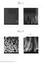 Fig. 02 - Method of producing chitosan scaffold having high tensile strength and chitosan scaffold produced using the method