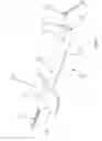 Fig. 02 - Delivery and Deployment Device For Surgical Web