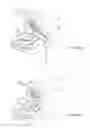 Fig. 10 - Delivery and Deployment Device For Surgical Web