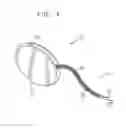 Fig. 02 - Incontinence treatment device