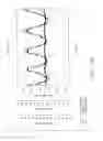 Fig. 34 - Method of conditioning a hybrid synthetic tubular structure to yield a functional human hybrid coronary bypass graft