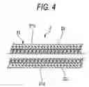 Fig. 05 - ENDOSCOPIC TREATMENT TOOL