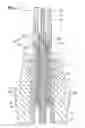 Fig. 07 - Treatment tool for endoscope