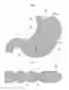 Fig. 07 - Endoscopic treatment tool and suturing method using the same