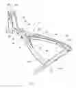 Fig. 02 - Bone retractor tool