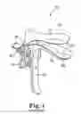 Fig. 02 - Speculum blade covers