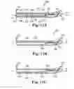 Fig. 10 - Speculum blade covers