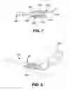 Fig. 04 - Retractor system for internal in-situ assembly during laparoscopic surgery