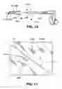 Fig. 06 - Retractor system for internal in-situ assembly during laparoscopic surgery