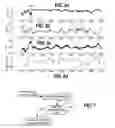 Fig. 05 - RELIABILITY IN DETERMINATION OF CLINICAL STATE OF A SUBJECT