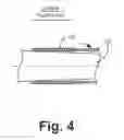 Fig. 05 - Medical lead delivery device