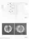 Fig. 06 - Method for accelerating data acquisition in dynamic magnetic resonance measurements (MRT) using parallel imaging