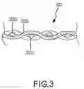 Fig. 04 - Ultrasonic attenuation materials