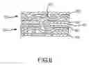 Fig. 06 - Ultrasonic attenuation materials