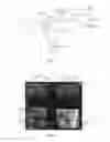 Fig. 06 - Method and apparatus for measuring flow in multi-dimensional ultrasound