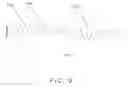 Fig. 10 - Pulmonary Artery Pressure Signals And Methods of Using